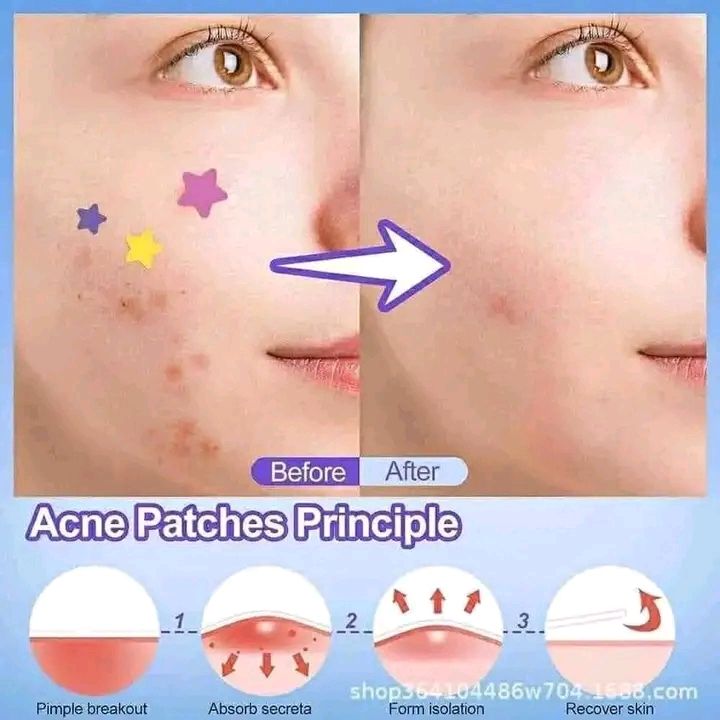 Acne patch 3