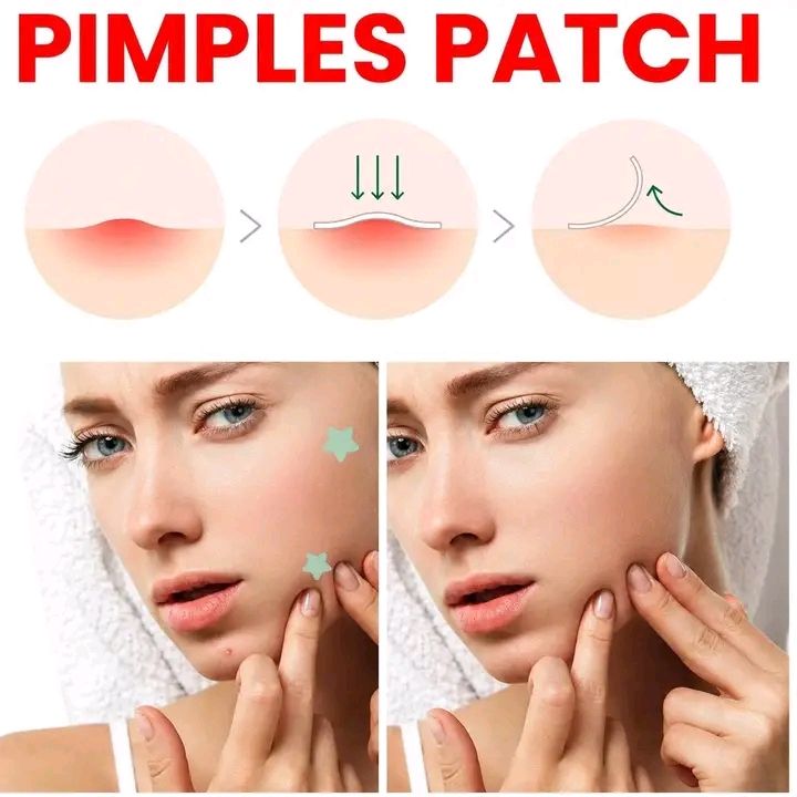 Acne patch 2
