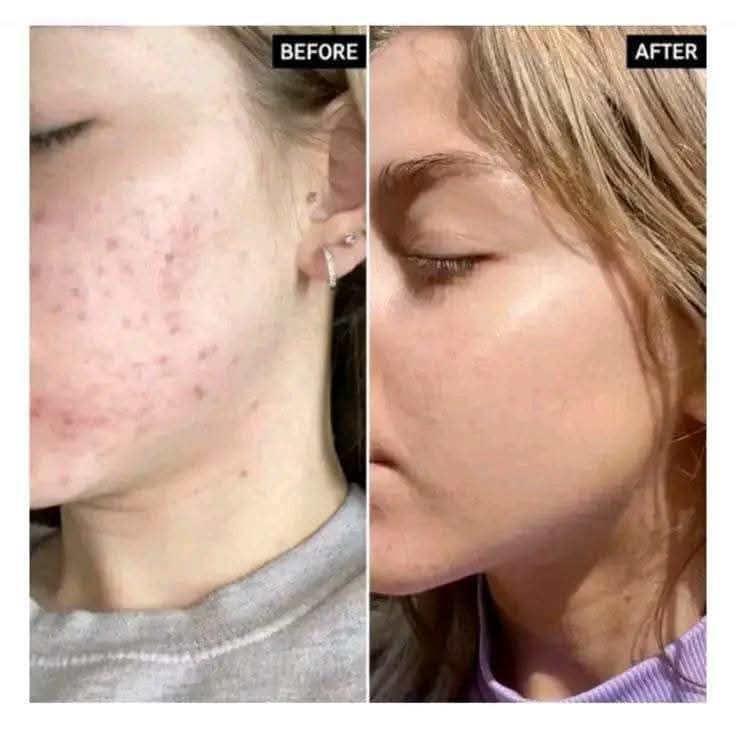 Dr.Althea 345 cream 2